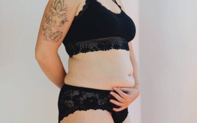 Brzuch po cesarce jak się go pozbyć bezpiecznie dla zdrowia